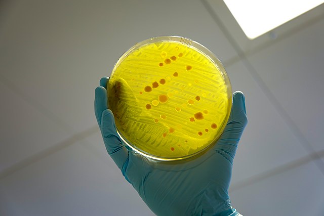 Cresomycin-Enhanced-Antibiotic-Bolsters-Efforts-Against-Resistant-Bacteria