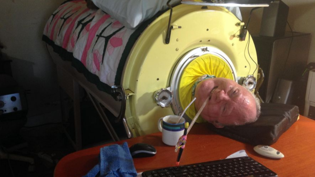 Paul Alexander, 78, of Dallas Dies After Living in An Iron Lung for Most of His Life!