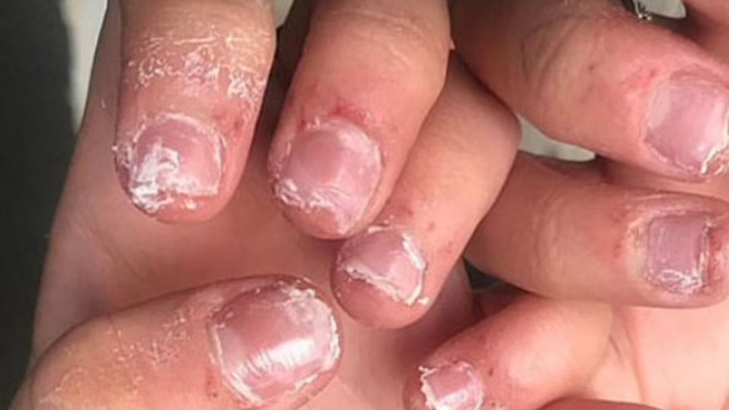 How to Stop Burning from Nail Primer Without Harm to Your Nails!