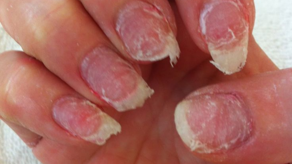 How to Stop Burning from Nail Primer Without Harm to Your Nails!