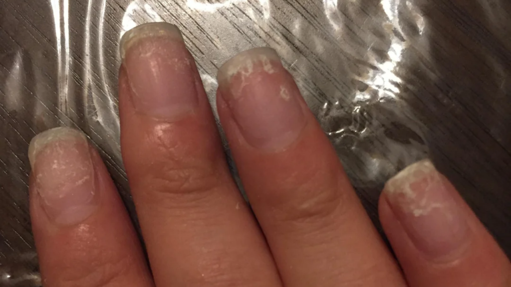 How to Remove SNS Powder Nails Without Harm to Your Real Ones!