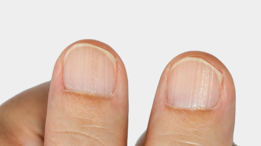How to Remove Ridges from Nails!