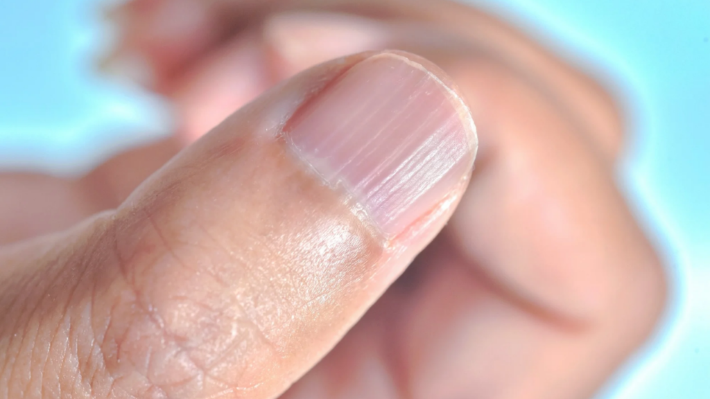 How to Remove Ridges from Nails!